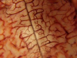 Flickr-Brain-Lnk_Si_-300x225